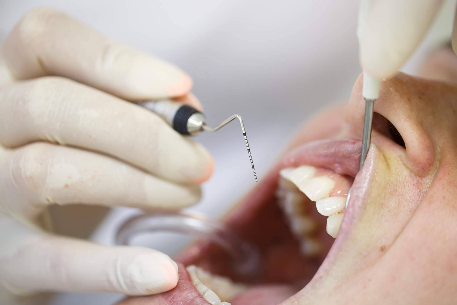 Eira Dental, verdaderos especialistas en endodoncia y periodoncia